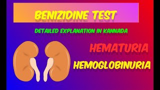 Benzidine test detailed explanation in KannadaBlood in urineDMLTBMLT [upl. by Valsimot]