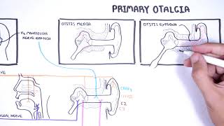 Understanding Ear Pain  Otalgia Innervation of ear mechanism of ear pain and causes [upl. by Herson826]