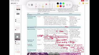 Adenocarcinoma Respiratory 54  First Aid USMLE Step 1 in UrduHindi [upl. by Celinda18]