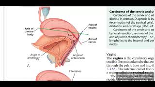 Uterus anteverted amp anteflexed [upl. by Pamelina596]