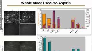 Cellix Webinar Thrombosis [upl. by Higgs]