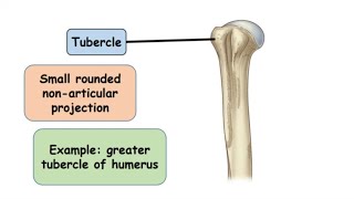 Tubercle Bone Marking [upl. by Ohs498]