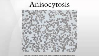 Anisocytosis [upl. by Aketal110]