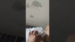 hip injection vlog ll buttocks injection vlogs ll intramuscular injection procedure ll buttocks llll [upl. by Giovanni]