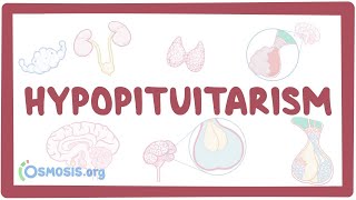 Hypopituitarism  causes symptoms diagnosis treatment pathology [upl. by Marcell547]