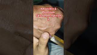 Amoxicillin amp potassium Calvuanate injection ipshrort trending medicalprocedure drxsachin12 [upl. by Aiki]