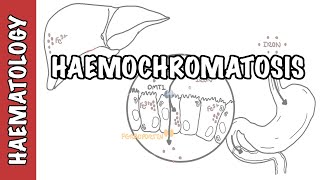 Haemochromatosis Iron Overload  iron physiology causes and pathophysiology [upl. by Ayoral215]