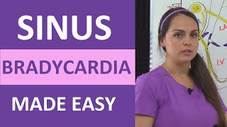 Sinus Bradycardia ECGEKG Interpretation Causes Treatment Nursing NCLEX Review Cardiac [upl. by Zaria]