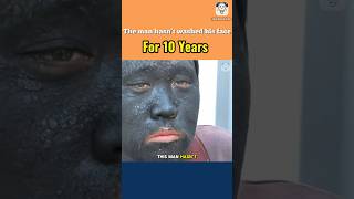 This man hasn’t washed his face for 10 years [upl. by Osithe]