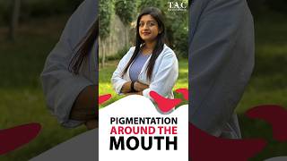 Pigmentation Around the Mouth  Home Remedies [upl. by Asa]