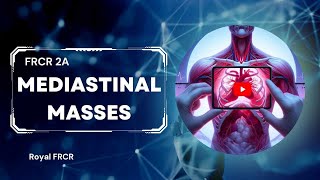 15  Chest Imaging for FRCR [upl. by Agnot]