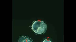 Human blastocyst day 3 to 6 [upl. by Eentihw]