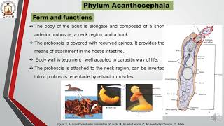 Phylum Acanthocephala [upl. by Gualterio]