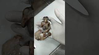 Amazing real human fetus specimen [upl. by Ttezil]