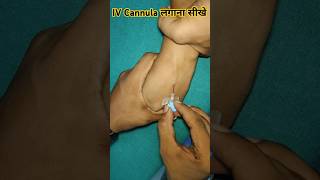 184 IV Cannulation Technique [upl. by Dianemarie446]