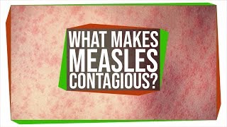 Why Is The Measles Virus So Contagious [upl. by Yrennalf]