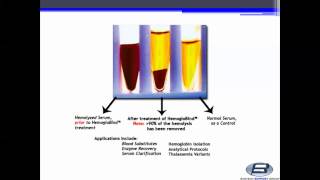 Biotech Support Group HemogloBind™ Hemoglobin Depletion From Hemolyzed SerumPlasma [upl. by Einaej829]