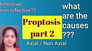 Classification and causes of Proptosis  Axial or non axial proptosis [upl. by Eslek]