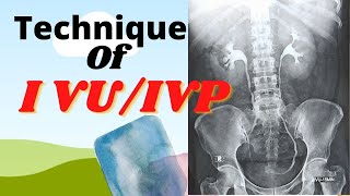 Technique of IVUIVP Ep36 Intravenous urogrampyelogram Procedure of IVUIVP test [upl. by Alameda]