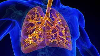 What is Tracheobronchomalacia by WJ Svetanoff  OPENPediatrics [upl. by Sibyl202]