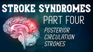 Stroke Syndromes Part 4 of 4  Posterior Circulation Strokes [upl. by Andeee312]