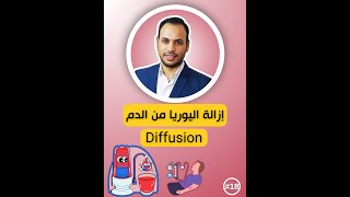 إزالة اليوريا من الدم Diffusion medicalstudentmegadialysis اكسبلور dialysis الغسيلالكلوي [upl. by Yralih]