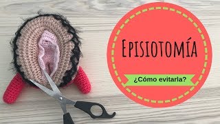 La EPISIOTOMIA ✂️ ¿cómo puedo evitarla [upl. by Margetts478]