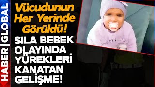 Sıla Bebek Olayında Kan Donduran Gelişme Vücudunun Her Yerinde Görüldü [upl. by Assyli826]