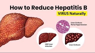 How to Reduce Hepatitis B Viral Load Naturally  How to Reduce Hepatitis B [upl. by Ayikaz]