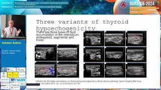 Ushakov AV Pathogenesis of thyroid stromal swelling  BGRSSB2024 [upl. by Ahsier]