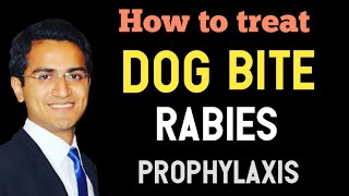 Dog Bite Rabies Virus Emergency Treatment Rabies SymptomsPostExposure Prophylaxis Vaccine USMLE [upl. by Ynnaffit]