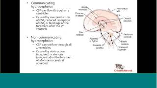 Fetal Hydrocephalus [upl. by Akinom]