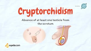 Cryptorchidism  Undescending Testicles  Causes Pathology  Pediatrics Video Lecture [upl. by Laet]