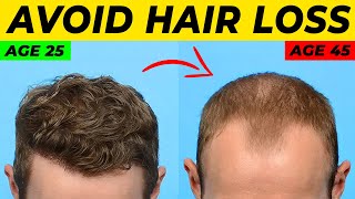 Topical Finasteride For Hair Loss What YOU Need To Know [upl. by Eltsryk84]