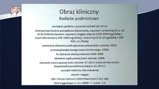 Osteoporoza kiedy leczenie może być groźniejsze od samej choroby [upl. by Dream715]