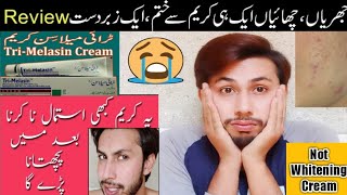 TriMelasin Cream Review in Urdu  Best cream for freckles But Not for whitening [upl. by Ahcilef731]