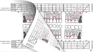 Ficha Periodontal [upl. by Buchbinder]