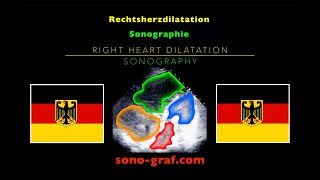 Echokardiographie  Rechtsherzdilatation [upl. by Eilahs]