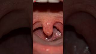 Punching Bag of Our Mouth  UVULA 👅  3D Animation [upl. by Adekahs]