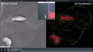 Starch granules in banana cells [upl. by Nirahs]