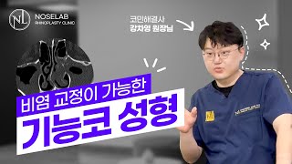 비염 교정이 가능한 기능코성형 [upl. by Syned]