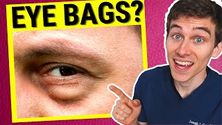 Eye Doctor Explains How to Get Rid of Under EYE BAGS [upl. by Annala980]