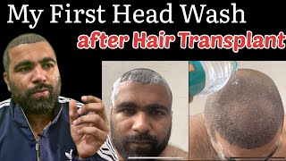 First Head Wash after Hair Transplant  My Condition after 5 Days of Hair Transplant [upl. by Eneres]