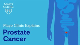 Mayo Clinic Explains Prostate Cancer [upl. by Sherar496]