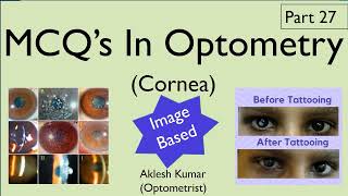 MCQ’s in Optometry  Cornea  Part 27 [upl. by Maryjane]