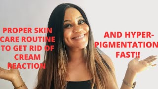 HOW TO GET RID OF CREAM REACTION AND HYPERPIGMENTATION USING VITAMIN SERUM IN THIS WAY [upl. by Itsud504]