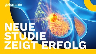 Neue Studie zeigt Erfolg Kommt bald eine BrustkrebsImpfung [upl. by Netsryk]