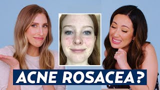 Can You Have Acne AND Rosacea Dermatologist Reacts to Danas Skincare Routine  DERM REACTS [upl. by Fendig]