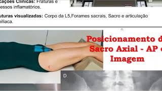 Posicionamento Radiológico da Coluna Sacral  Técnicas Radiológicas II [upl. by Atims952]