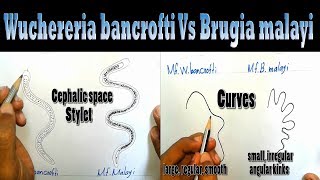 Difference between Wuchereria bancrofti and Brugia malayi Clear Explanation [upl. by Rajiv]